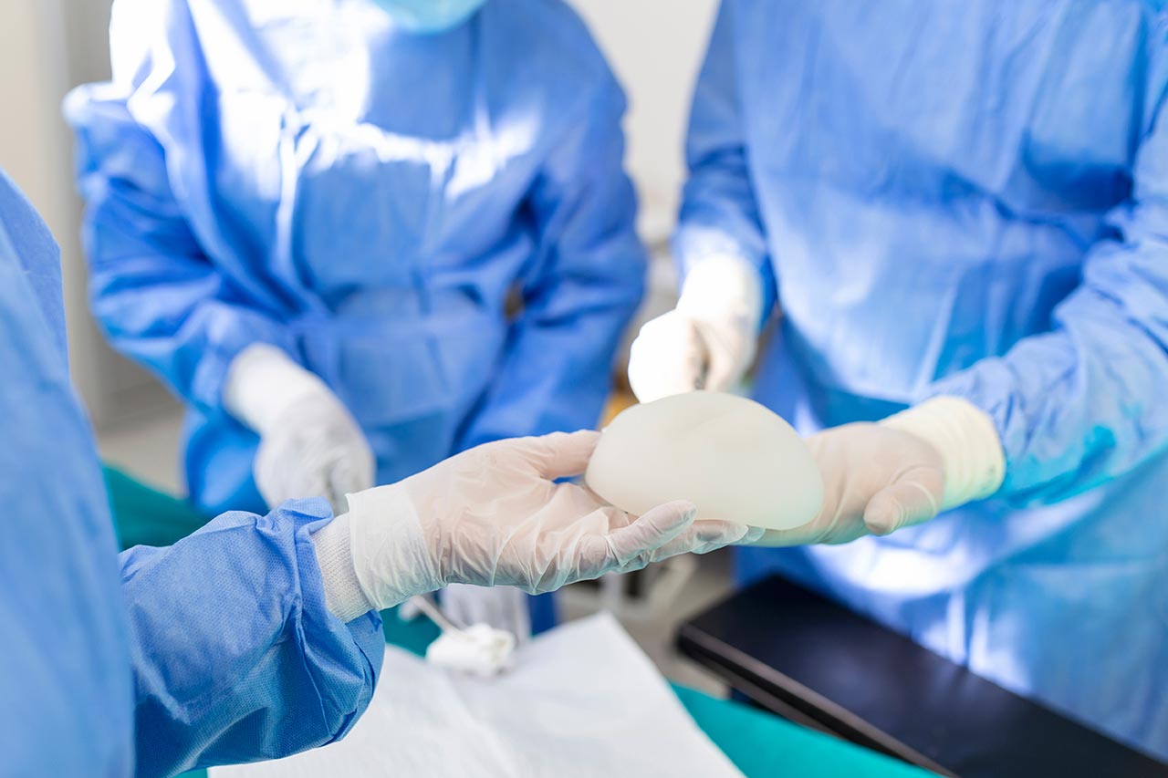 breast implants agence cabinet conseil consulting