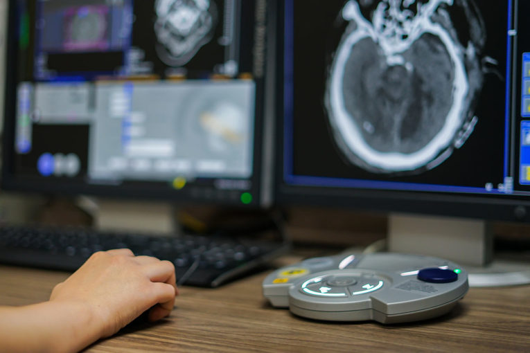 Oncology consulting