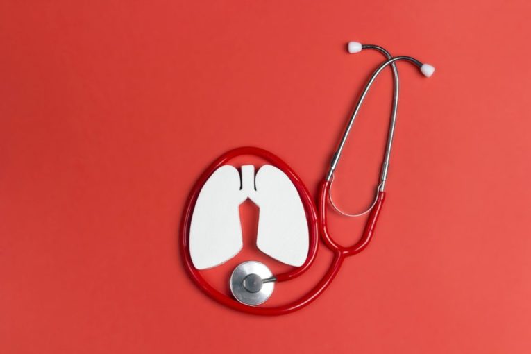 diagnosis of lung cancer innovation agence cabinet conseil consulting