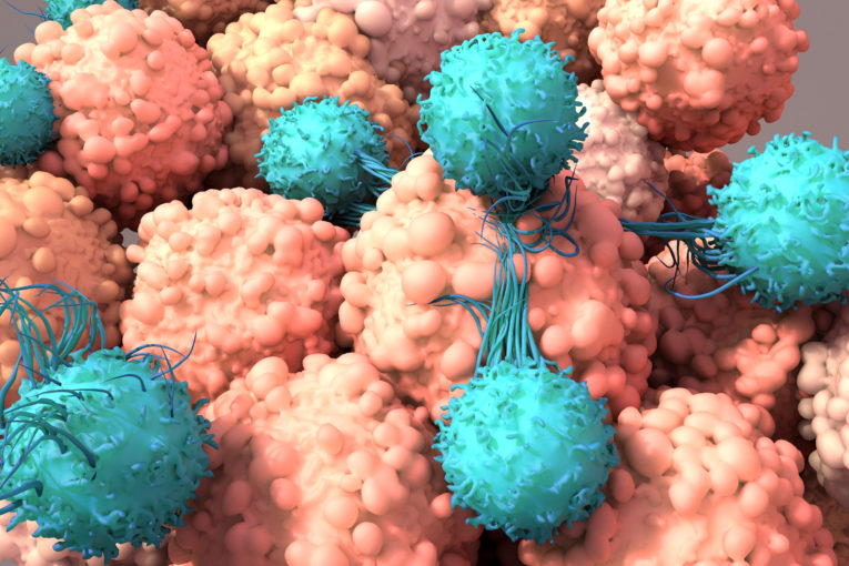 CAR-NK Cell Therapy cancer treatment?