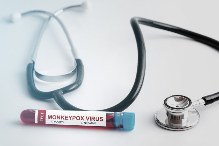 spread of monkeypox consulting