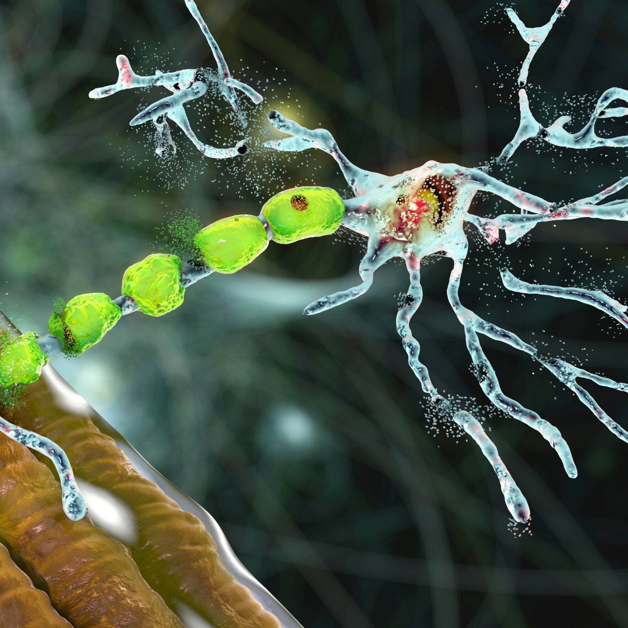 sclerose plaques agence cabinet conseil consulting