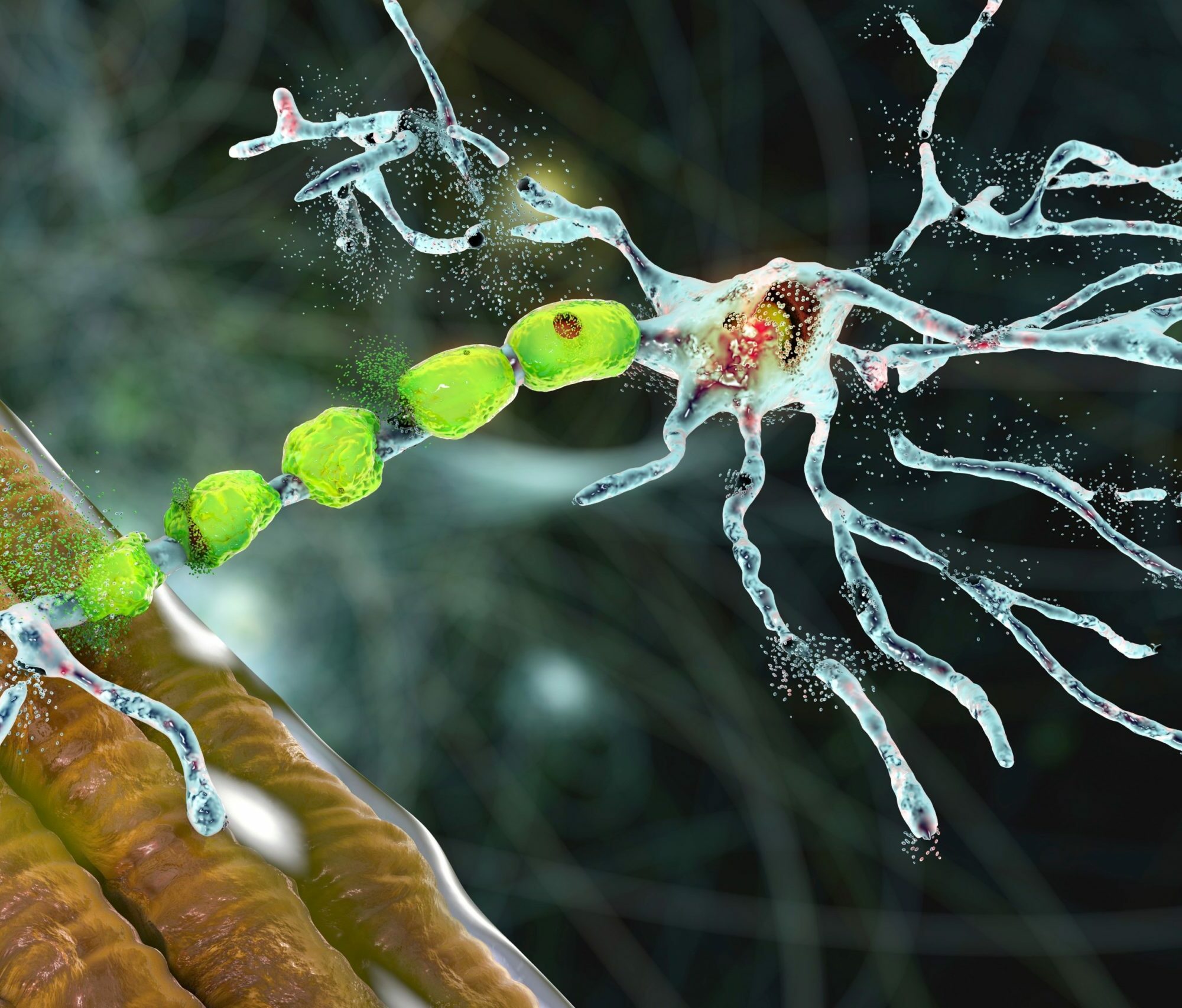 Multiple Sklerose Agentur Unternehmensberatung Beratung Consulting