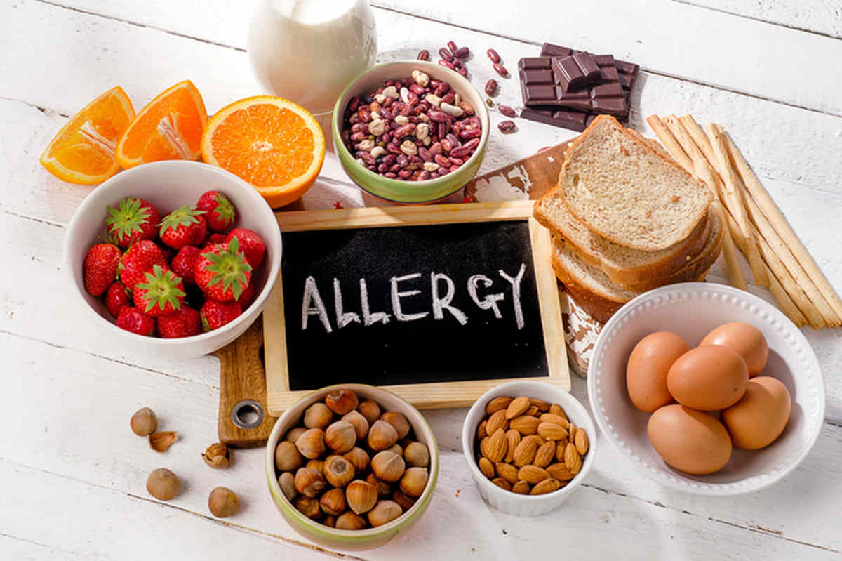 gestion allergies alimentaires agence cabinet conseil consulting
