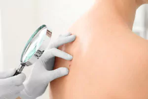 photodynamische Therapie Agentur Unternehmensberatung Beratung Consulting