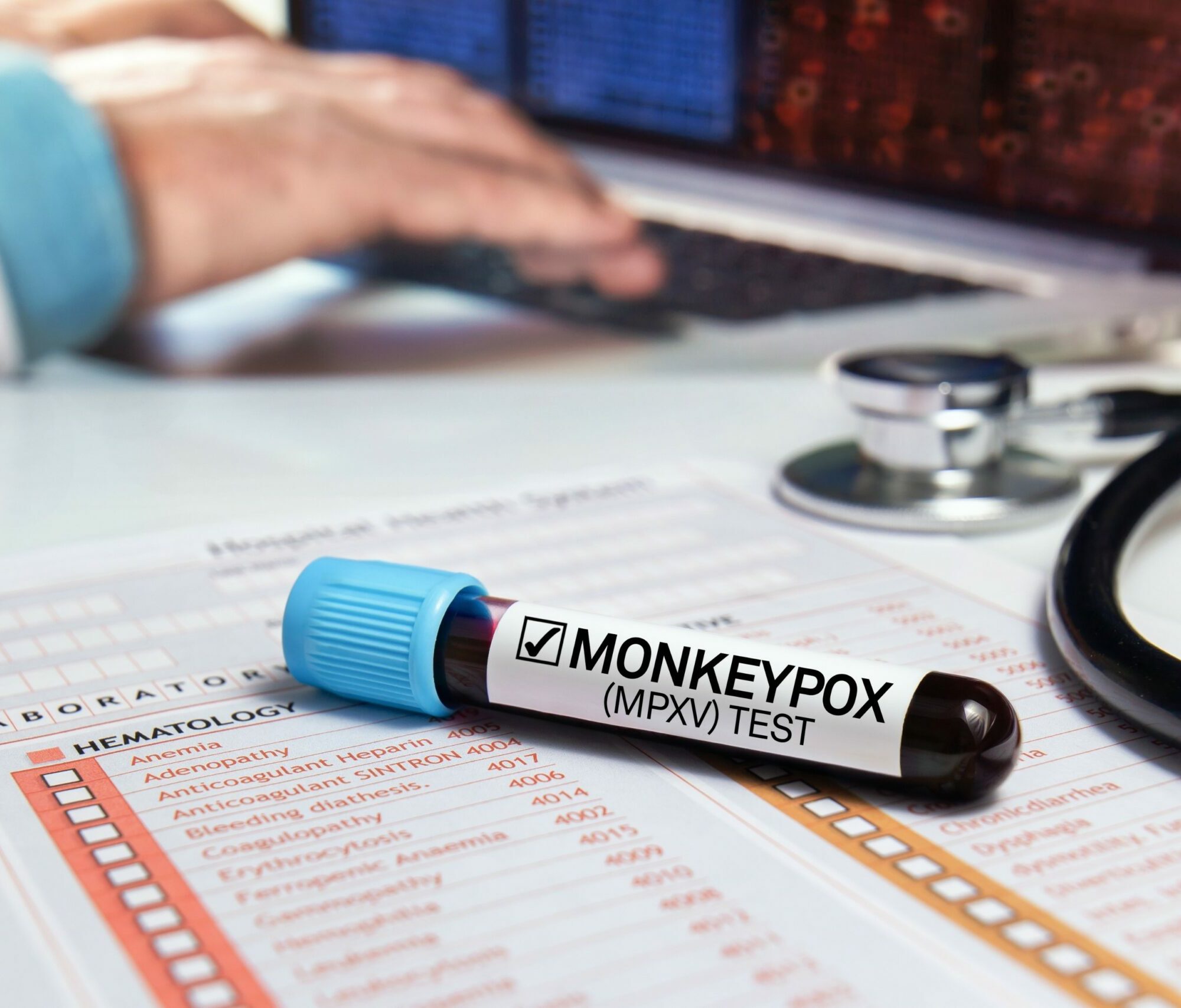 Affenpocken Szenarien Agentur Unternehmensberatung Beratung Consulting