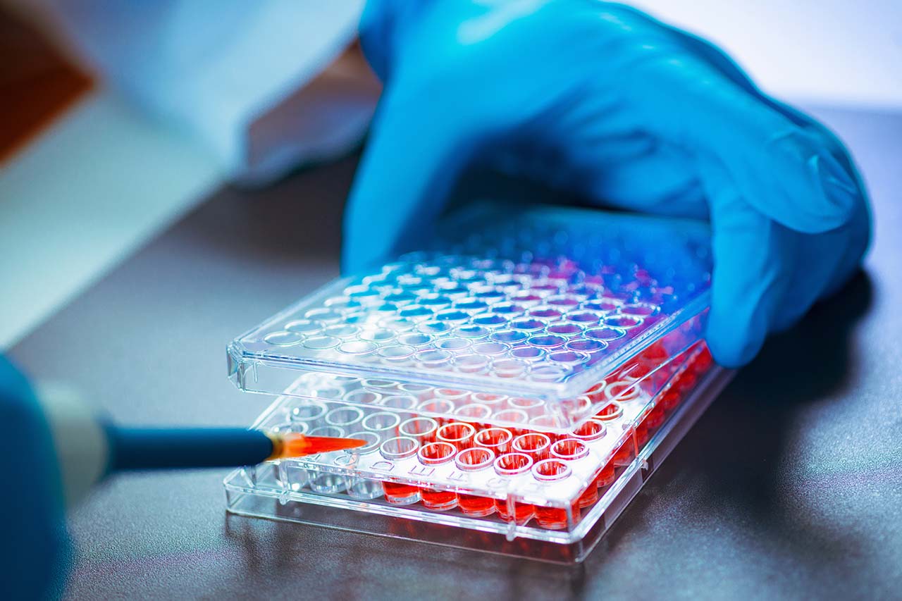 Biotech Belgien Agentur Unternehmensberatung Beratung Consulting