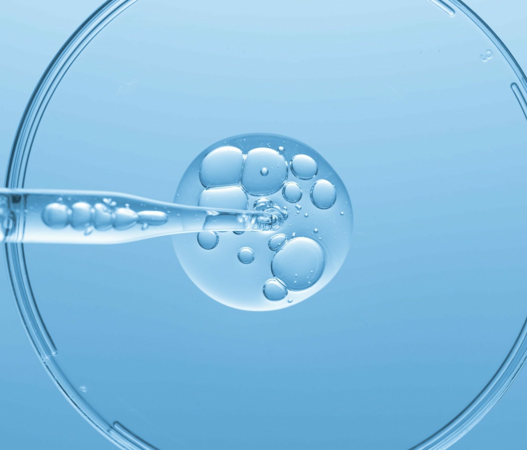 Hyaluronsäure Markt Agentur Unternehmensberatung Beratung Consulting