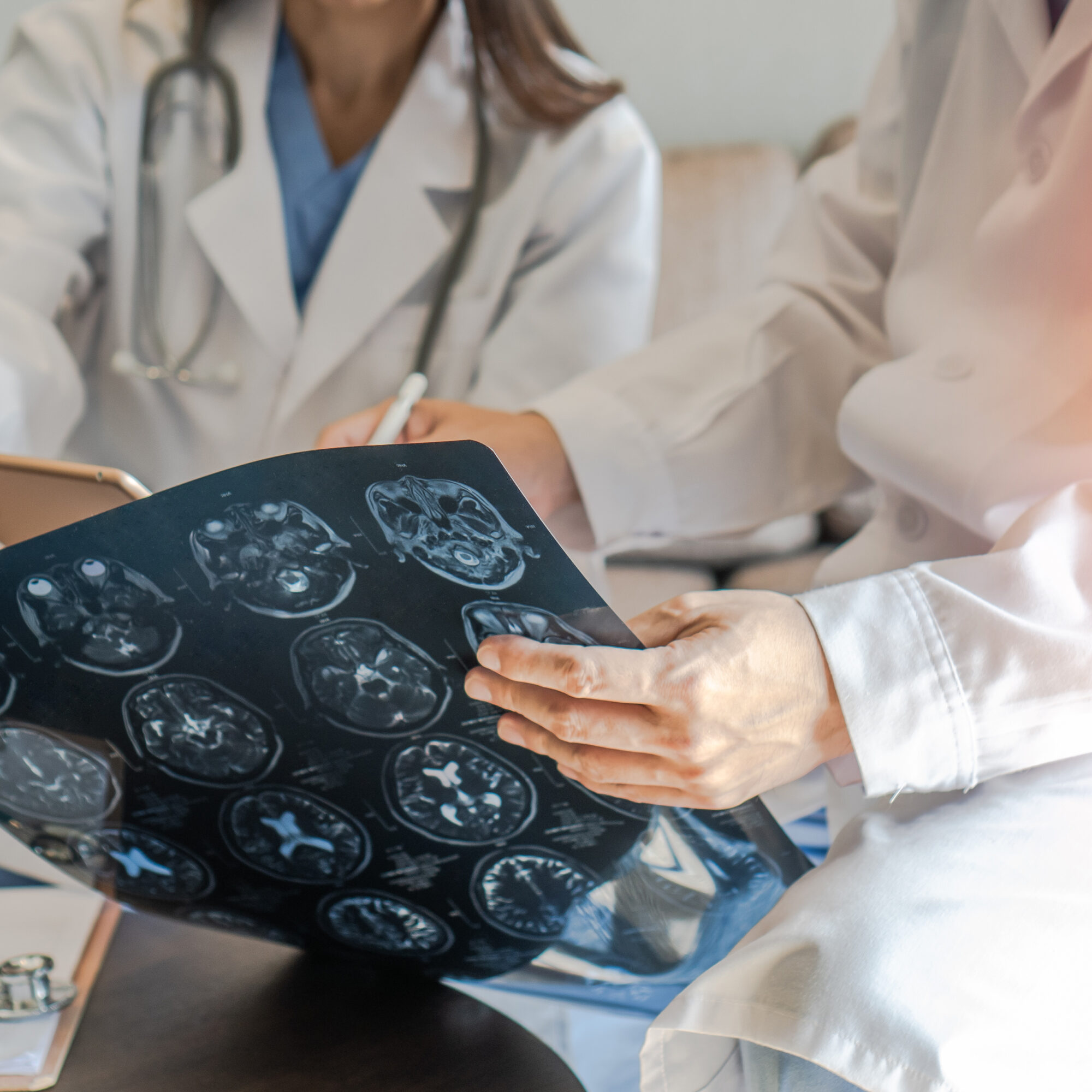 neurological disorders treatments agency consulting consultancy experts