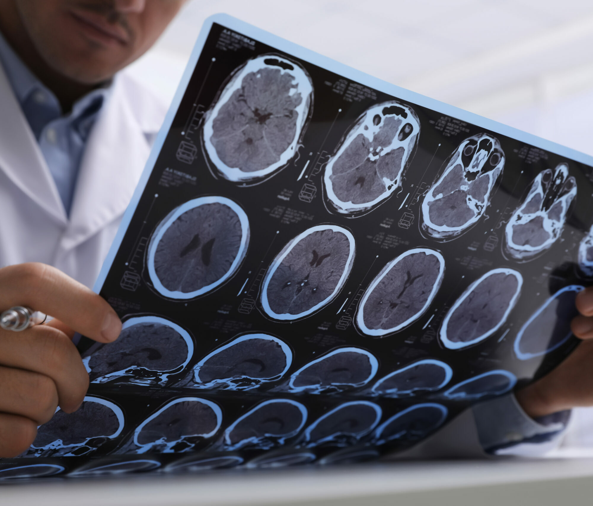 Long COVID Alzheimer Agentur Unternehmensberatung Beratung Consulting